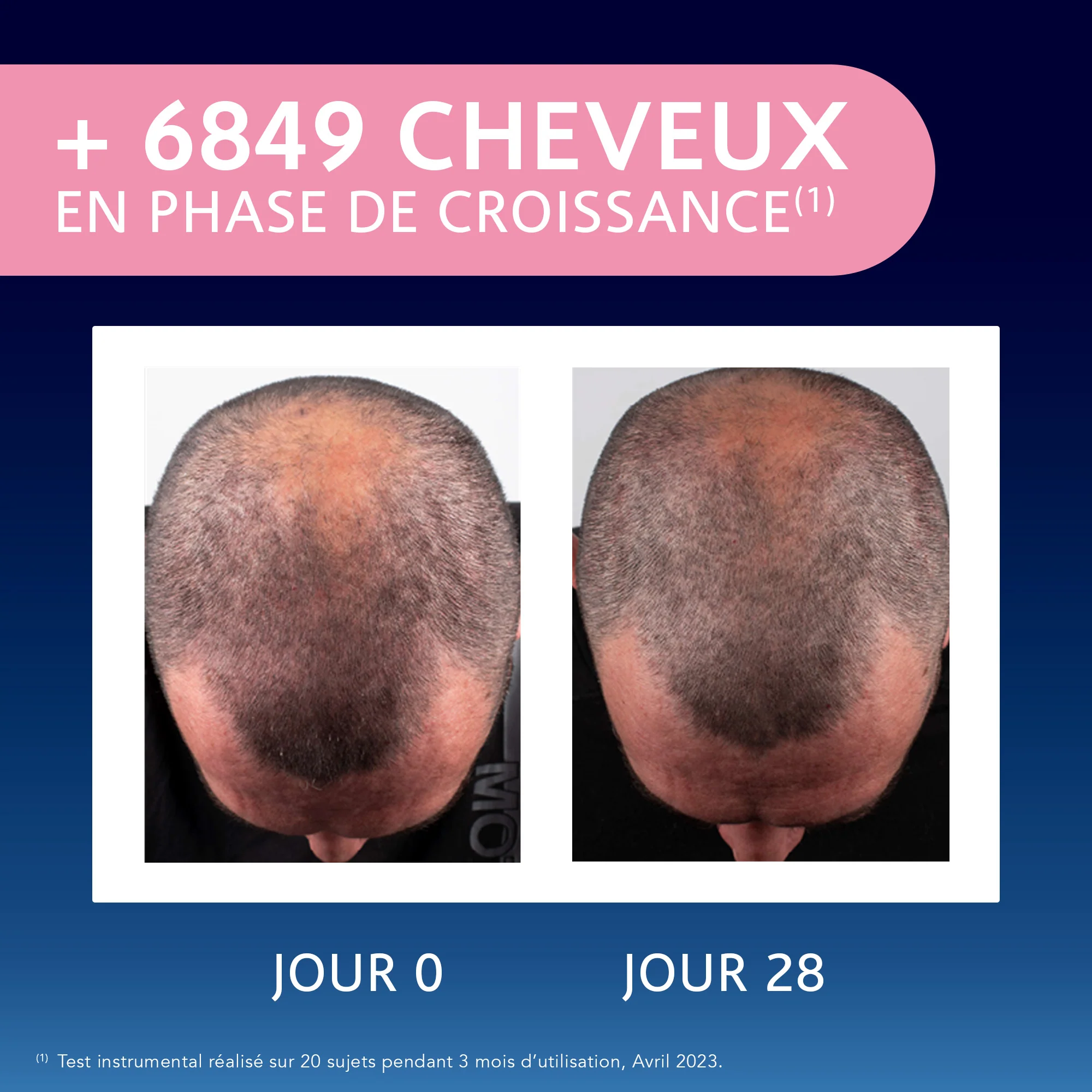 Forcapil® Elixir Croissance - Image 7